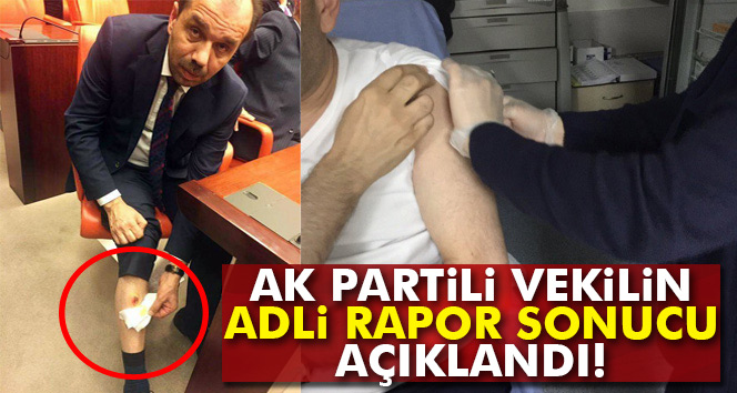 Adli Tıp 'AK Parti Trabzon Milletvekili ısırıldı' dedi