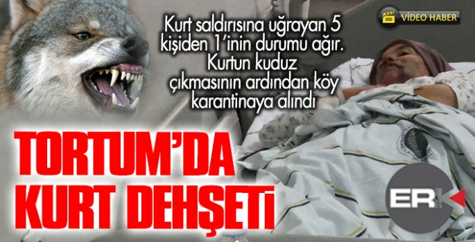 Erzurum’da kurt dehşeti: 5 yaralı 
