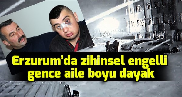 Erzurum’da zihinsel engelli gence aile boyu dayak