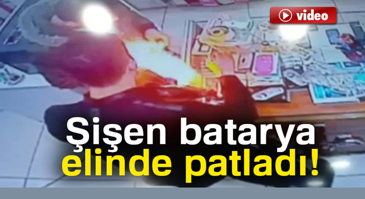 Şişen batarya elinde patladı