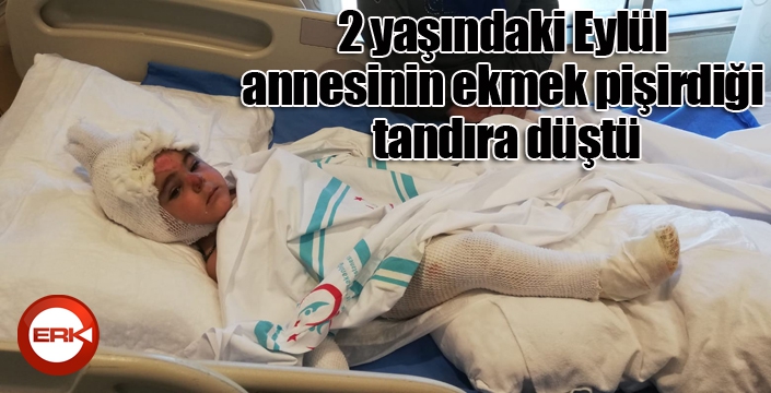 2 yaşındaki Eylül annesinin ekmek pişirdiği tandıra düştü