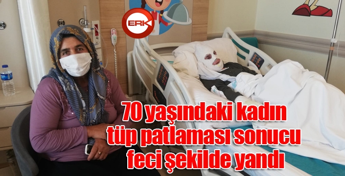 70 yaşındaki kadın tüp patlaması sonucu feci şekilde yandı