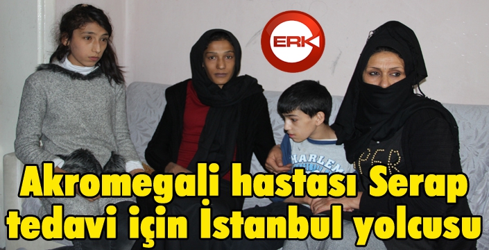 Akromegali hastası Serap tedavi için İstanbul yolcusu 