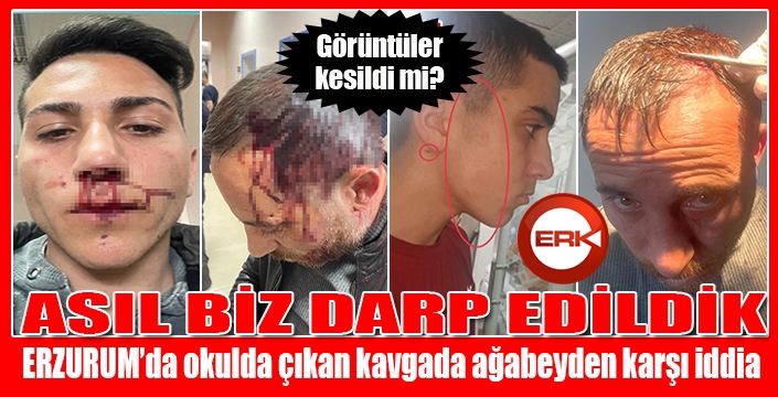 ASIL BİZ DARP EDİLDİK