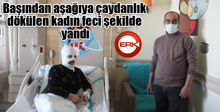 Başından aşağıya çaydanlık dökülen kadın feci şekilde yandı