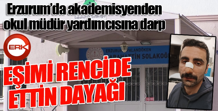 Erzurum'da akademisyenden okul müdür yardımcısına darp...