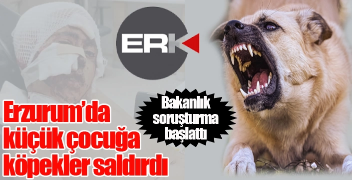 Erzurum'da köpeklerin saldırdığı çocuk tedavi altında...