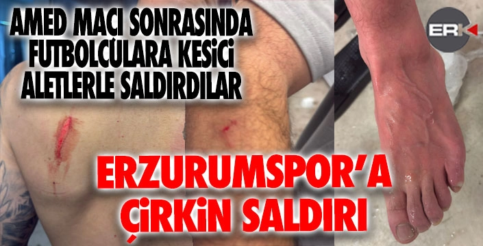 Erzurumspor'da Diyarbakır'da çirkin saldırı!