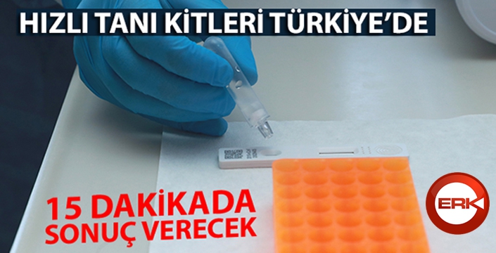 Hızlı tanı kitleri Türkiye'de