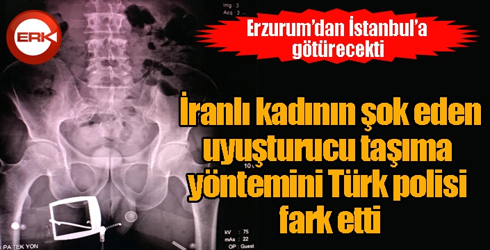 İranlı kadının şok eden uyuşturucu taşıma yöntemini Türk polisi fark etti