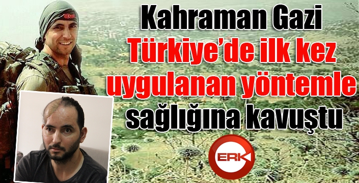 Kahraman Gazi, Türkiye’de ilk kez yapılan yöntemle sağlığına kavuştu