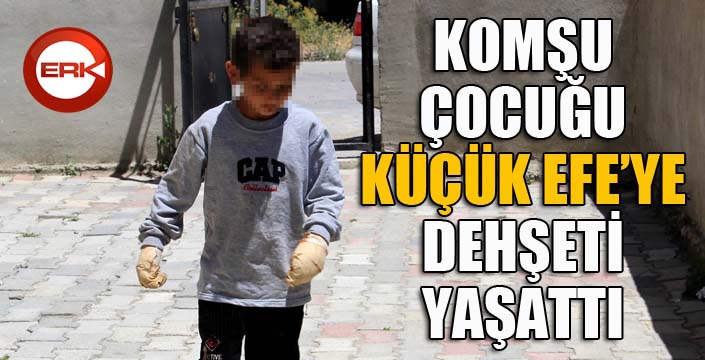 Komşu çocuğu, küçük Efe’ye dehşeti yaşattı