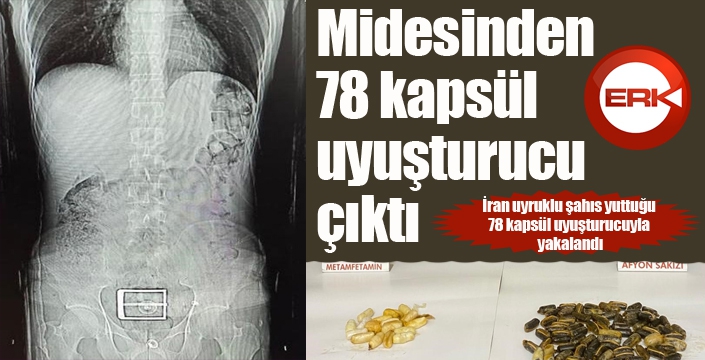 Midesinden 78 kapsül uyuşturucu çıktı