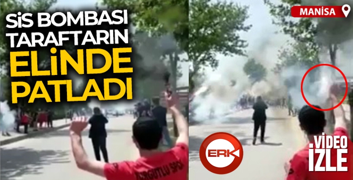 Sis bombası taraftarın elinde patladı