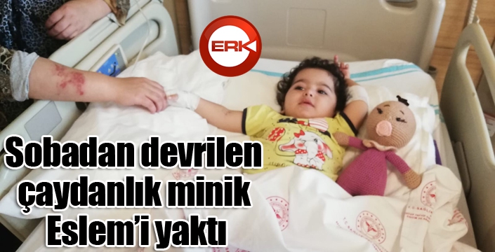 Sobadan devrilen çaydanlık minik Eslem’i yaktı