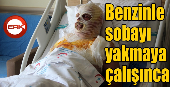 Sobayı benzinle yakmaya çalışınca...